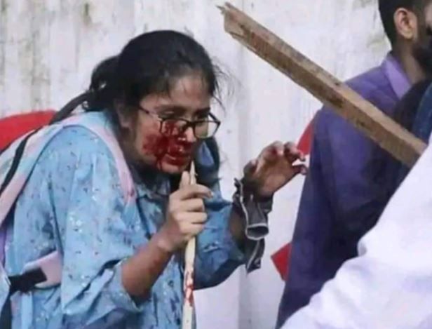 মধ্যরাতে উত্তাল, দিনে রণক্ষেত্র, অতঃপর রক্তাক্ত-অসহায় বাংলাদেশ, মানুষের মুখে মুখে ফিরছে 'স্বৈরাচারী হাসিনার পতন ঘটাও, দেশ বাঁচাও, মানুষ বাঁচাও'!