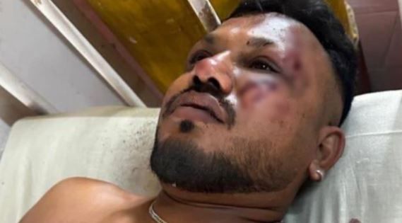 আমদাবাদে বিমান দুর্ঘটনায় রক্ষা পেলেন ৪০ বছরের ব্রিটিশ নাগরিক বিশ্বকুমার রমেশ!