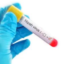 নিপা আতঙ্কে রাজ্য! বারাসতে দুই নার্স আক্রান্ত, কড়া নজরে স্বাস্থ্যদফতর