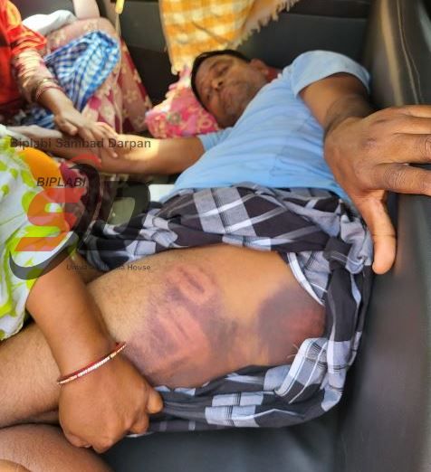 গুজবের ভিডিও ঘিরে কেশপুরে তীব্র উত্তেজনা-পুলিশি মারধরের অভিযোগে রাজ্য সড়ক অবরোধ, নামানো হল অতিরিক্ত বাহিনী!