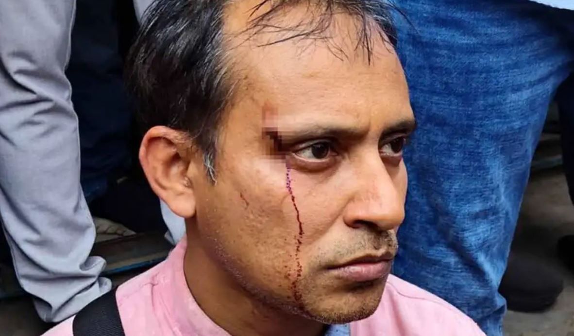 ‘মুখ্যমন্ত্রীর প্রচার’ দেখানো নিয়ে বিতর্ক, প্রতিবাদ করতেই শিক্ষক প্রহৃত!