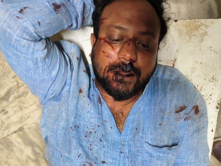 বাঁকুড়ার স্কুলডাঙায় সংগ্রামী যৌথ মঞ্চের বৈঠক শেষে হামলার অভিযোগ, গুরুতর জখম শিক্ষক নেতা অরিন্দম মণ্ডল!